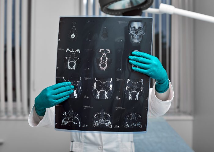 doctor attentively examines the mri scan of the pa 2025 01 09 12 27 57 utc scaled