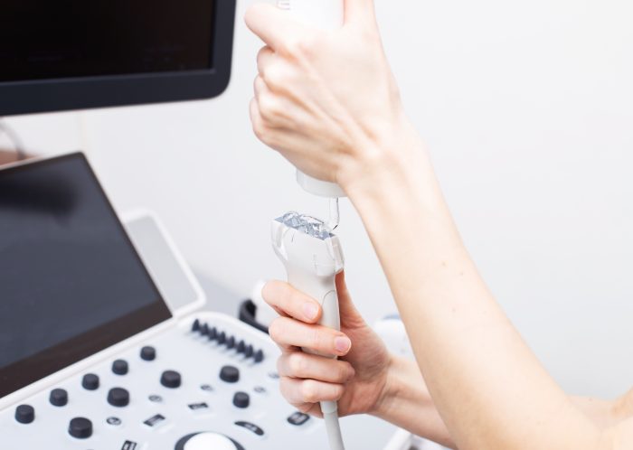 woman doctor s hand applies a medical gel to ultra 2025 02 12 05 12 31 utc scaled